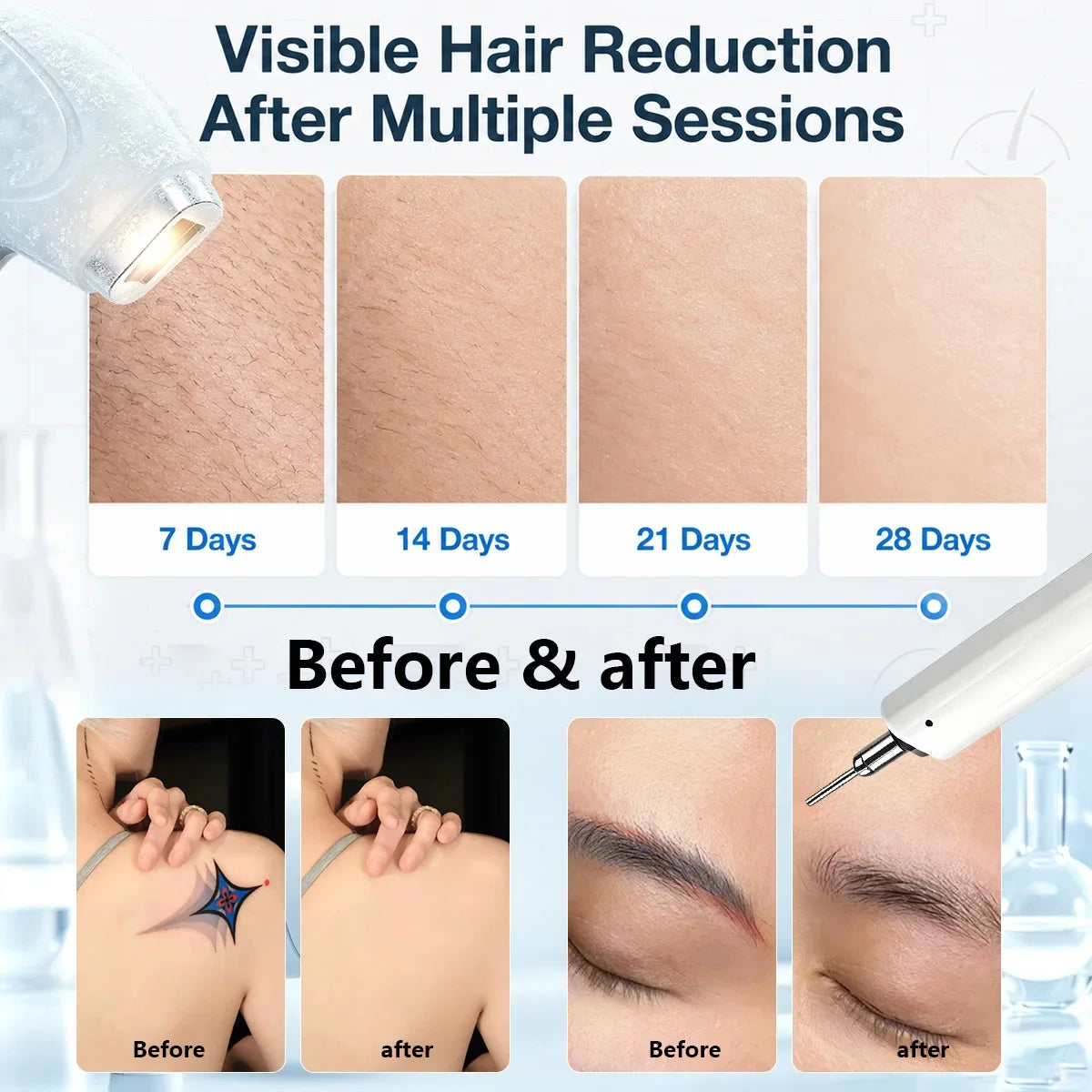 808nm Diode Laser High Efficiency Hair Removal Machine 5 Waves Painless Permanent Portable 5000W Beauty Salon Cooling Handle
