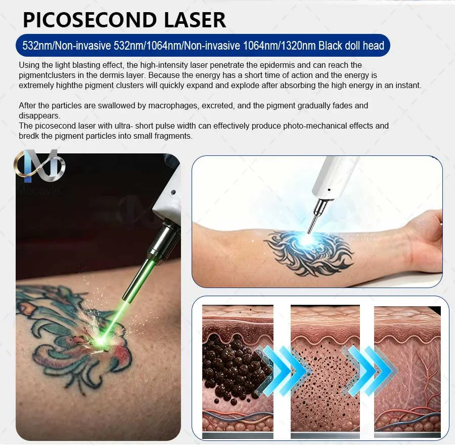 808nm Diode Laser High Efficiency Hair Removal Machine 5 Waves Painless Permanent Portable 5000W Beauty Salon Cooling Handle